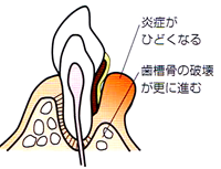 プラーク3